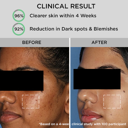 Face wash before and after oily skin